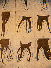 Grafik ber die verschiedenen Wurzelfllungen